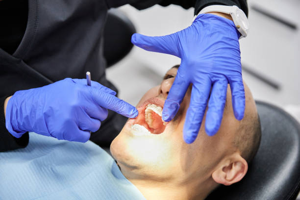 Best Emergency Treatment for Dental Infections or Abscesses in Levittown, NY